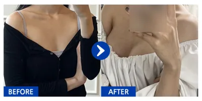 [Babytalk] Ментор хөхний хагалгаа 1 сар / Никнэйм: 한솔솔바람