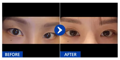 [Gangnam Unni] Байгалийн наалдац (Давхраа) 1 сар / Никнэйм: 킬러연습생