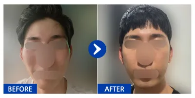 [Gangnam Unni] Шанаа 1 сар / Никнэйм: firnrb