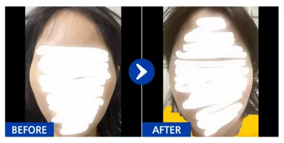 [Ганнам Унни] Шанааны мэс засал хийлгээд 1 сар / Хэрэглэгчийн нэр: qweasdfgh