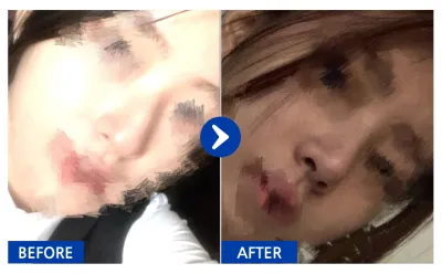 [Бабиток] Хамарны мэс засал хийлгээд 1 сар / Хэрэглэгчийн нэр: 냥이gRtzK