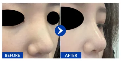 [Бабиток] Хамарны мэс засал хийлгээд 1 сар / Хэрэглэгчийн нэр: 융이나