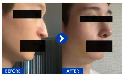 [Бабиток] Хамарны мэс засал хийлгээд 1 сар / Хэрэглэгчийн нэр: 여우9Kcqw