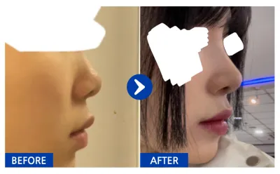 [Бабиток] Хамарны мэс засал хийлгээд 1 сар / Хэрэглэгчийн нэр: 코코먼