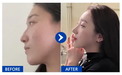 [Бабиток] Хамарны мэс засал хийлгээд 1 жил / Хэрэглэгчийн нэр: atmospe