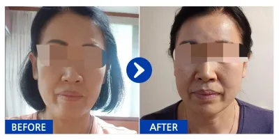 [Бабиток] Утас татуулах мэс засал хийлгээд 1 сар / Хэрэглэгчийн нэр: 냥이b6sKx