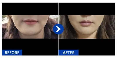 [Ганнам Унни] Утас татуулах мэс засал хийлгээд 1 сар / Хэрэглэгчийн нэр: 이미선.