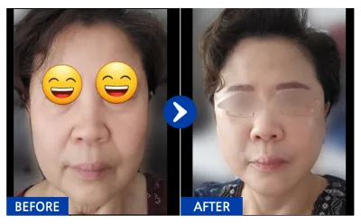 [Ганнам Унни] Утас татуулах мэс засал хийлгээд 1 сар / Хэрэглэгчийн нэр: 엽기토깽이