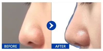 [Gangnam Unni] Хамар / 1 сар / Ник нэр: nacola