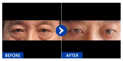 [Gangnam Unni] Доод зовхины хагалгаа, хөмсөг өргөх хагалгаа / 1 сар / Ник нэр: 비제이띠