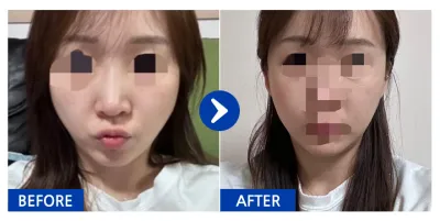 [Gangnam Unni] Шанаа / 1 сар / Хэрэглэгчийн нэр: Жиний-эун