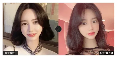 [Babytalk сэтгэгдэл] Нүдний хагалгаа 1 сар болж байна / Ник нэр: y3409