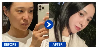 [Babytalk] Хамарны мэс засал / 1 долоо хоног / Хэрэглэгчийн нэр: Куокка u0VdN