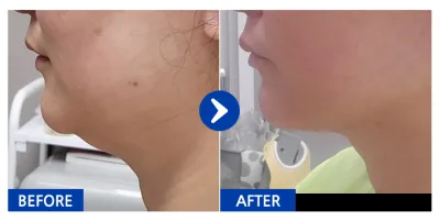 [Gangnam Unni] Өөх соруулах / 1-р шат / Никнейм: Сожүнсаранмам