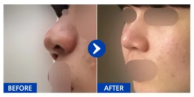 [Gangnam Unni] Хамар / 1 сар болж байна / Никнейм: И Га-он 12