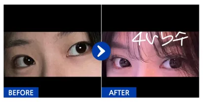 [Gangnam Unni] Байгалийн наалдац (давхраа) / 1 сар болж байна / Никнейм: Минт Чоко Баббл Ти