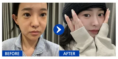 [Gangnam Unni] Хамрын дахин хагалгаа / 2 сар болж байна / Никнейм: Хайрүигба