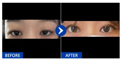 [Babytalk] Байгалийн наалдац (давхраа) / 2 долоо хоног болж байна / Никнейм: Тыни ба найзууд