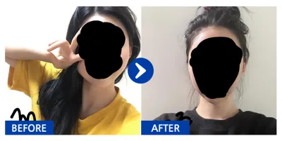 [Gangnam Unni] Шанаа, Дөрвөлжин эрүү 1 сар болж байна / Никнейм: Арарарараранг