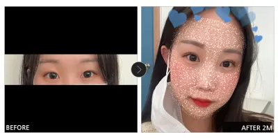 [Gangnam Unni сэтгэгдэл] Нүдний хагалгаа 1 сар болж байна / Ник нэр: 꽃신신자