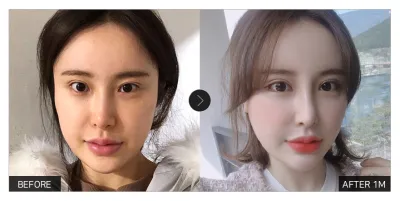 [Gangnam Unni сэтгэгдэл] Нүдний мэс засал хийлгээд 1 сар болж байна / Никнейм: 2233332222