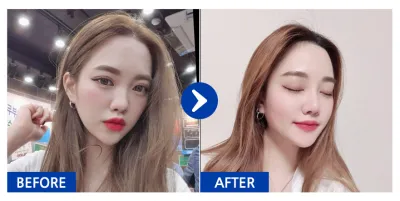 [Babytalk] Хамрын хагалгаа / 5 сар болж байна / Ник нэр: 둉둉이잉