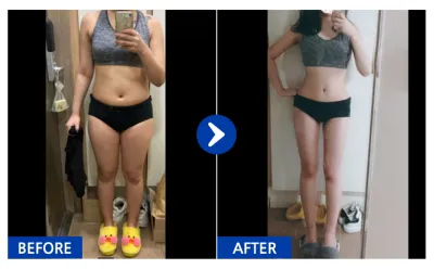 [Gangnam Unni] Бүх биеийн өөх соруулах / 3 сар болж байна / Ник нэр: 솜사탕모구