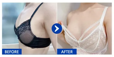 [Gangnam Unni] Хөхний хагалгаа (Sebbin Sub) / 1 сар болж байна / Ник нэр: 째유유