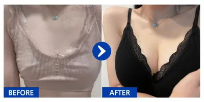 [Gangnam Unni] Хөхний мэс засал (Sebbin) / 3 сар болж байна / Никнейм: 횬니횬니