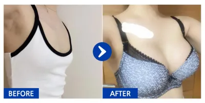 [Gangnam Unni] Хөхний мэс засал (Mentor) / 4 сар болж байна / Никнейм: 푸항하하