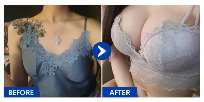 [Gangnam Unni] Хөхний мэс засал (Sebbin) / 9 сар болж байна / Никнейм: 코손실와용