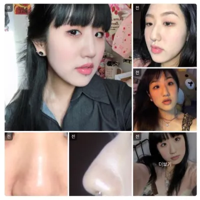 [Babytalk] Хамрын мэс засал / 1 дэх сар / Ник нэр: 김민지1111