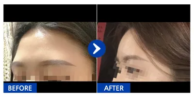 [Gangnam Unni] Өөх шилжүүлэн суулгах / 2 дахь сар / Никнэйм: 영ㅇ0