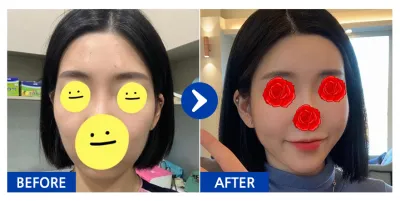 [Gangnam Unni] Өөх шилжүүлэн суулгах / Никнэй