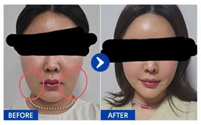 [Ганнам Онни] Өөх соруулах / 2 дахь сар / Ник нэр: 꼬부기님