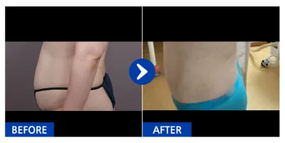 [Бабиток] Өөх соруулах / 1 дэх сар / Ник нэр: 꽃다운그자