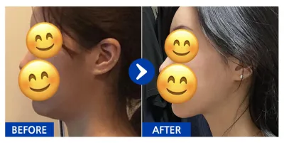 [Бабиток] Нүүрний өөх соруулах / 1 дэх сар / Ник нэр: 바비톡히