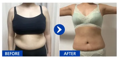 [Бабиток] Хэвлий, бугалганы өөх соруулах / 5 дахь сар / Ник нэр: 먹지마아는맛