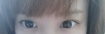 [Нүд] Мувистар7 - Ар, доод зовхины тайралт