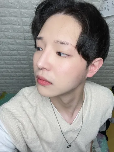 [Эрэгтэй] Хёк-с - Зүсэлттэй зовхи засвар, урд зүсэлт, хамар