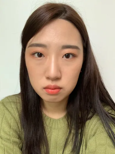 [Нүд] Шаралла - Зүсэлгүй Нүдний Хэлбэр Засвар, Урд Зүсэлт, Нүдний Доод Өөхөн Эдийг Сэргээн Байрлуулах