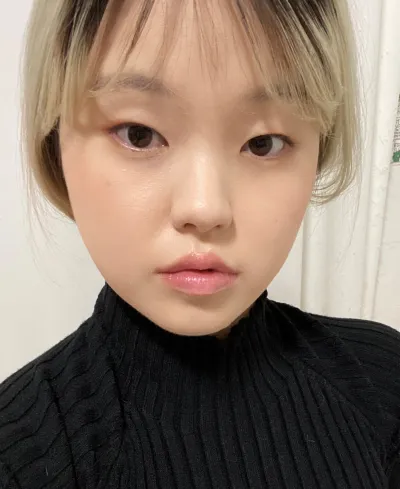 [Нүд] Моншири - Зүсэлгүй Нүдний Хэлбэр Засвар