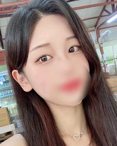 [Нүд] Туригусыл - Давхар зовхины оёдол (давтан хагалгаа), доод зовхины тайралт