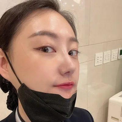 [Хамрын мэс засал] Milky Way - Хамрын нуруу, үзүүр, яс зүсэлт, бөхтэй хамар