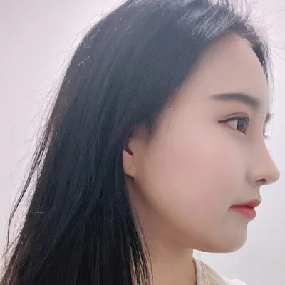 [Хамрын] Өвлийн гоё - Хамрын нуруу, үзүүрийг хугалж зассан