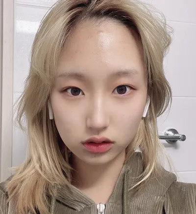 [Нүд] Мөсөн ширхэг - Зүсэлгүй зовхи засвар, хойд зовхи нээлт