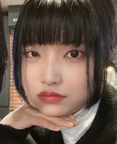 [Нүд] Чаннён - Зүсэлттэй зовхи заслын дахин хагалгаа