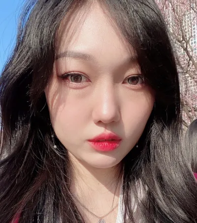 [Нүд] Салли - Нүдний доод уутны өөхөн эдийг дахин байрлуулах