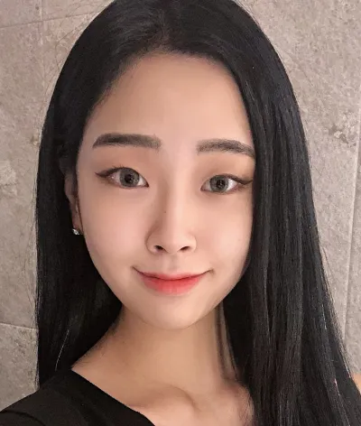 [Нүд] Улс - Булсан давхар зовхи, хойд зүсэлт, доод зүсэлт