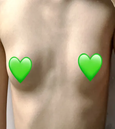 [Цээж] Шумуул устгах - Цээж